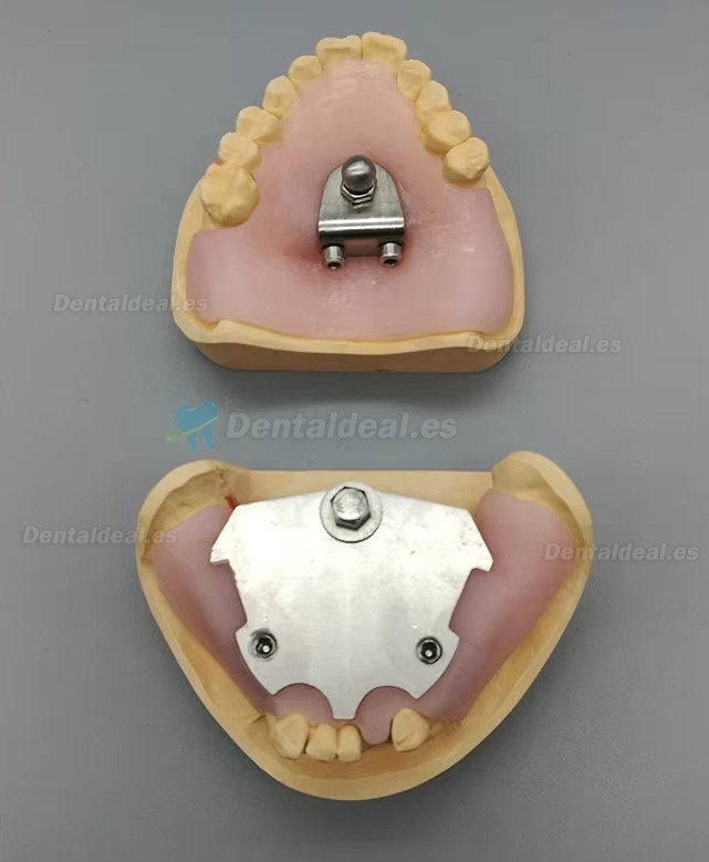 Registrador Relaci&oacute;n C&eacute;ntrica con Trazador Arco G&oacute;tico para Ed&eacute;ntulos